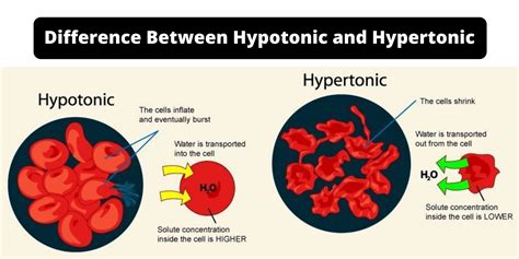 What Is The Difference Between Hypertonic And Hypoton - vrogue.co