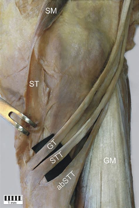 Pes anserinus (leg structure) | Semantic Scholar