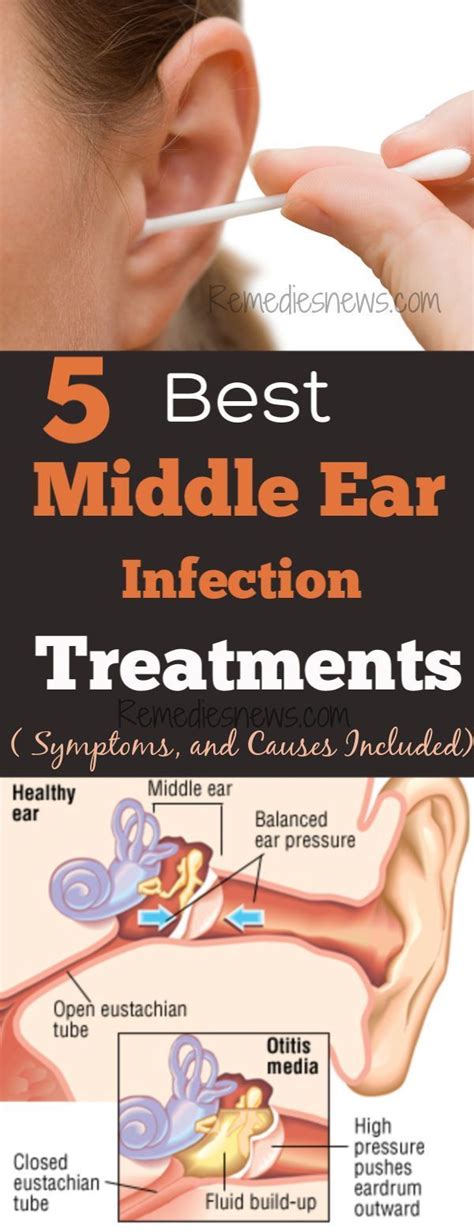 Middle Ear Infection Treatments, Symptoms, and Causes | Ear infection home remedies, Ear ...