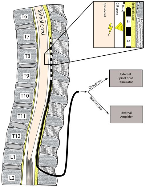 Frontiers | Epidural Spinal Electrogram Provides Direct Spinal ...