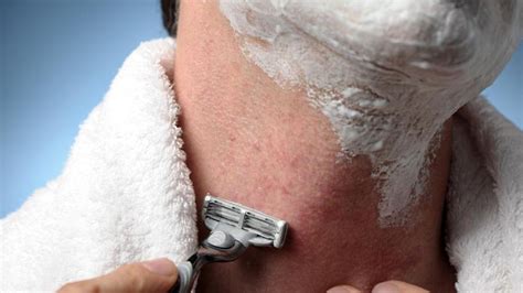 Razor Burn: Causes, Treatment and More – Forbes Health