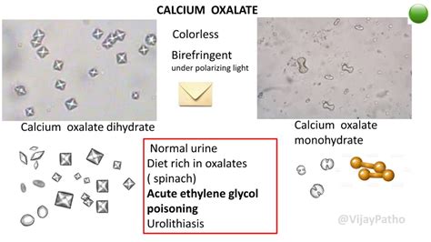 Calcium Oxalate Dihydrate Crystals In Urine