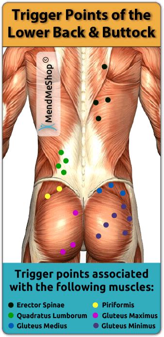 Erector Spinae Trigger Points