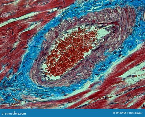 Histology Of A Heart Stock Photo - Image: 44133964