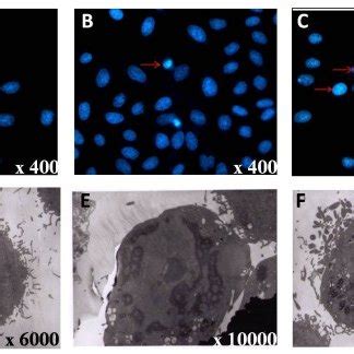 Chromatin condensation and nuclear fragmentation typical for apoptosis... | Download Scientific ...