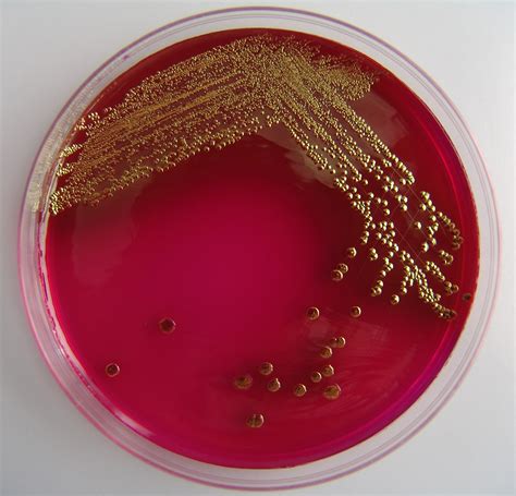 Escherichia Coli Infection (E. Coli)