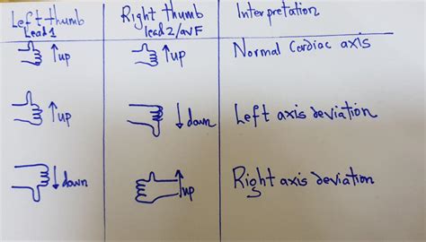 12 Lead Ecg Placement Mnemonic