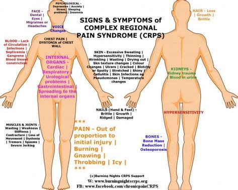 Complex Regional Pain Syndrome