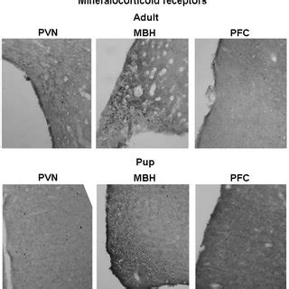 Representative pictures of mineralocorticoid receptor... | Download Scientific Diagram