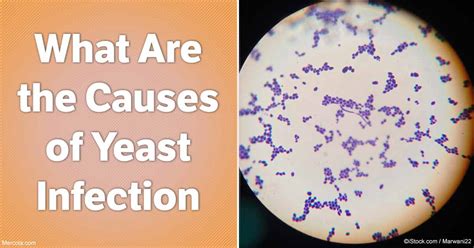 What Are the Causes of Yeast Infection?