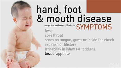 Heads up parents: Hand, foot and mouth disease is on the rise | WREG.com