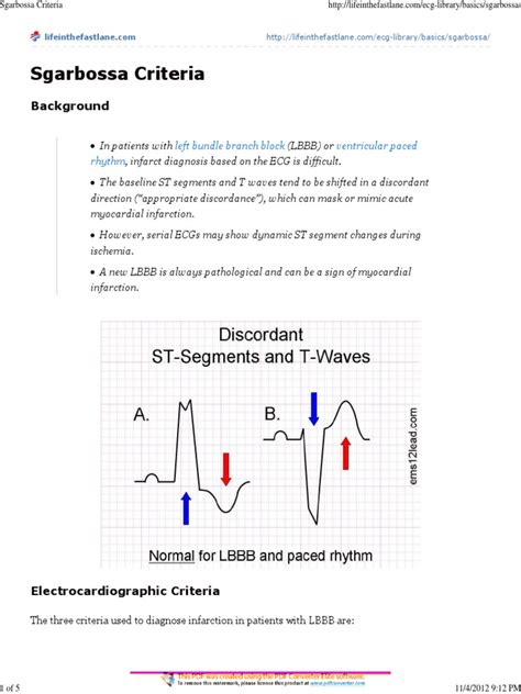 Sgarbossa Criteria | Electrocardiography | Myocardial Infarction