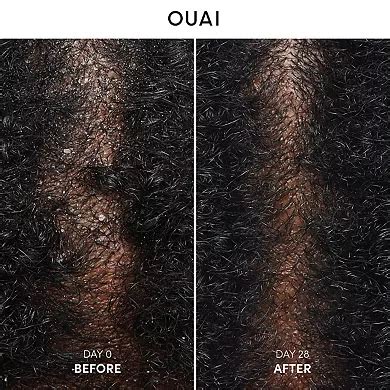 OUAI Anti-Dandruff Shampoo