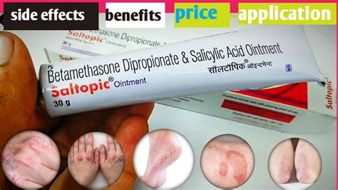 Saltopic Ointment | Betamethasone Dipropionate & Salicylic Acid ...