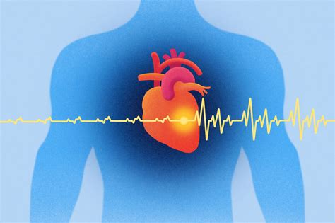 Find the Right AFib Treatment Options and Expertise - Advancing Your Health