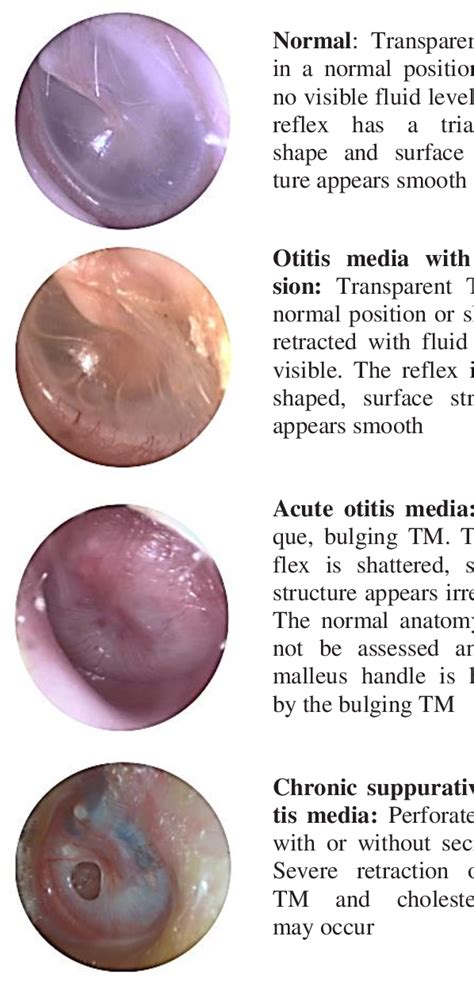 Figure 3 from AIDS FOR OTOLARYNGOLOGISTS DIAGNOSTIC EVALUATION OF ...