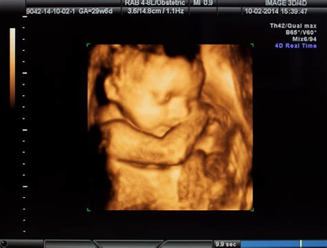 Ultrasound 3d Stock Photo - Download Image Now - iStock