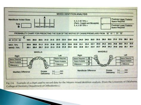 Mixed dentition analysis