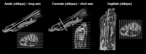 Foot Muscles Mri / Foot Muscles Mri Mri Ankle Anatomy Mri And Ultrasound Have Been Utilised In ...