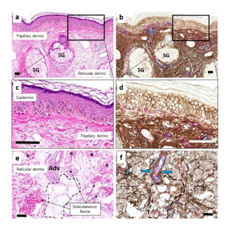 Interstitial spaces are continuous across tissue and organ boundaries ...