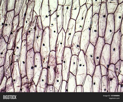 Micrograph Onion Epidermal Cells, Image & Photo | Bigstock