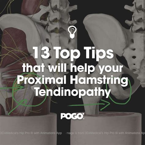 Exercises for Proximal Hamstring Tendinopathy | POGO Physio Gold Coast