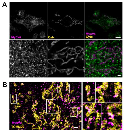 Myosin-Va colocalizes with mitochondrial network in A375 cell line. (A ...