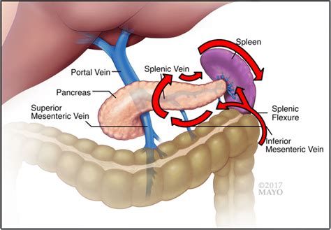 Five-step caudad-to-cephalad clockwise technique for laparoscopic... | Download Scientific Diagram