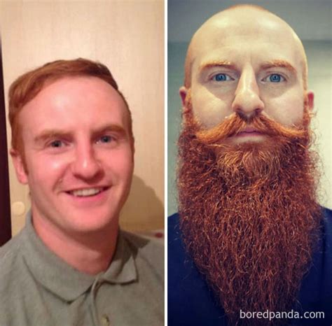 30 Before & After Pics That Will Make You Reconsider Shaving Your Beard ...