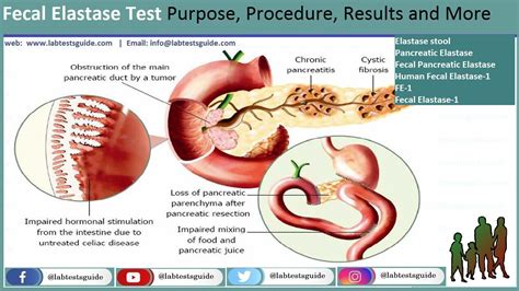 Pancreatic Elastase Test Purpose, Procedure, Results And More | Lab Tests Guide