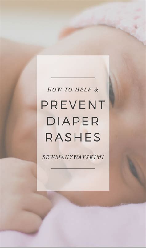 Help & Prevent Diaper Rashes | Diaper rash, New parent advice, Prevention