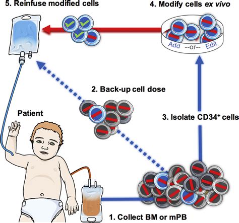 Hematopoietic Stem Cell Gene Therapy: Progress and Lessons Learned: Cell Stem Cell