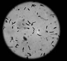 Environment & Nature News - Ancient bacteria take a breath - 07/02/2000