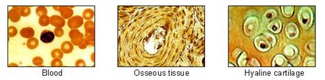 Connective Tissue Disorders - Physiopedia