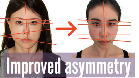 How I Improved My Facial Symmetry | Koko Face Yoga