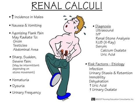 Urinary Calculi Flashcards | Quizlet