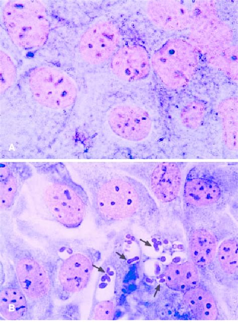 A HaCat control cells. B HaCat cells stained with the May- Grumwald ...