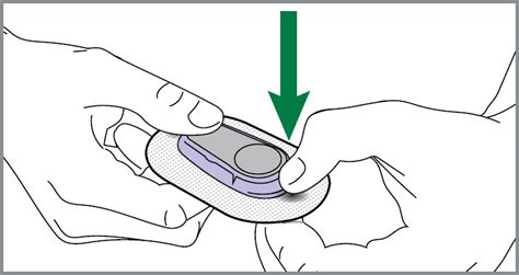 How to replace sensor and start sensor session | Dexcom