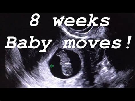 8 weeks ultrasound. Baby moves. - YouTube