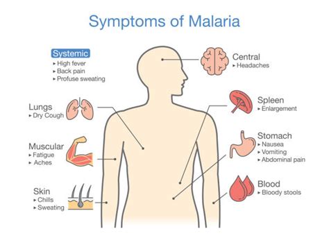 Malaria Muscle Stock Photos, Pictures & Royalty-Free Images - iStock