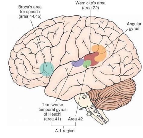 Primary auditory cortex. This area is located in the transverse temporal gyri (Heschl) of the ...