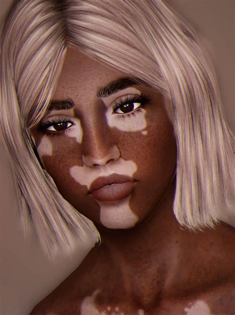 simplykitsch: “ As requested, the vitiligo skin I made at some point early last year and forgot ...