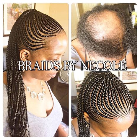 19 Black Hairstyles To Cover Alopecia | Hairstyles Street