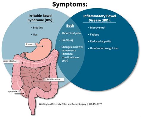 Irritable Bowel Syndrome - Amara Pain & Spine Management