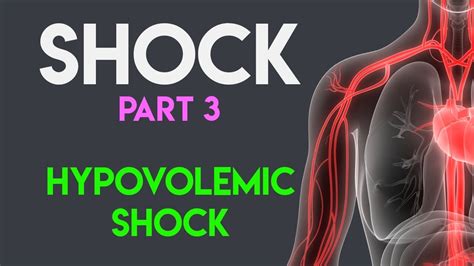 Hypovolemic Shock | Shock (Part 3) - YouTube