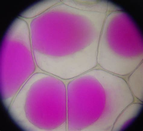 Difference Between Plasmolysis and Deplasmolysis | Definition ...