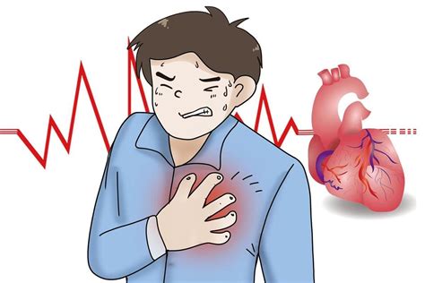 我国每年超54万人因为心源性猝死去世，专家：心血管病年轻化趋势明显，要从现在开始做好预防 | 极目新闻