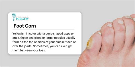 Corns - Premier Podiatry: Velimir Petkov, DPM: Podiatrists: Clifton, NJ