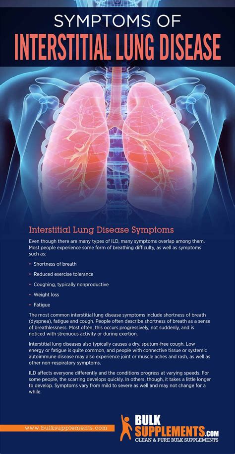 Tablo | Read 'Interstitial Lung Disease: Symptoms, Causes & Treatment' by