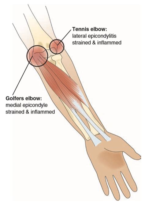 Anatomy Of The Elbow Muscles Discount Sale, Save 67% | jlcatj.gob.mx